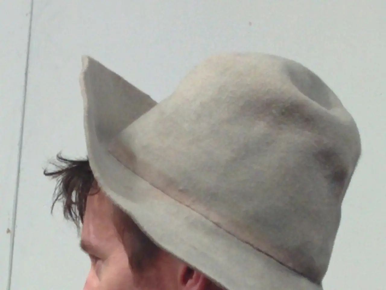 Symptoms, visuals, triggers, suitable shampoos, and creams related to scalp folliculitis explained.