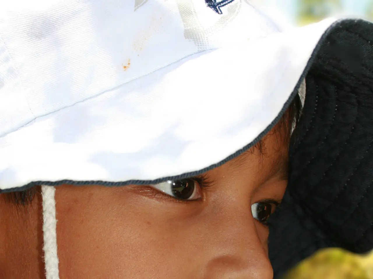 Childhood Mononucleosis: Signs, Causes, Remedies