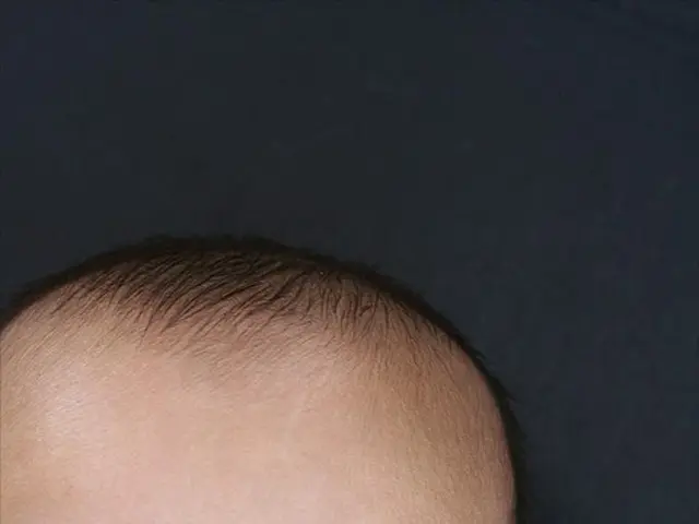 Pregnancy Week 11: Experienced symptoms, fetal growth, and hormonal changes