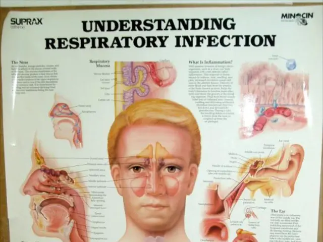 A reactive lymph node refers to a lymph node that has become enlarged in response to an infection...