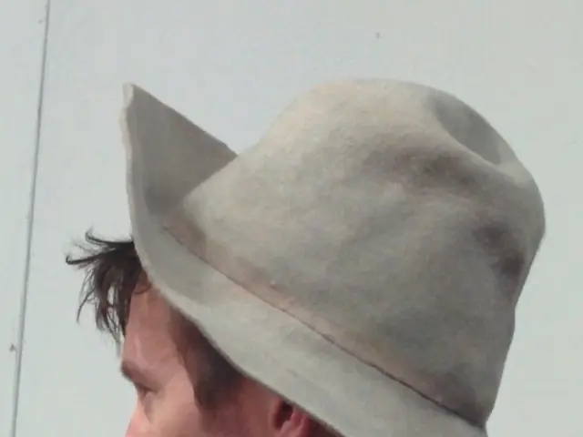 Symptoms, visuals, triggers, suitable shampoos, and creams related to scalp folliculitis explained.