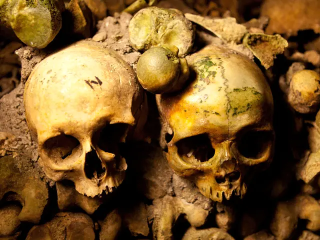 Individual in UAE nearly succumbs to severe headache, undergoes critical surgery resulting in...