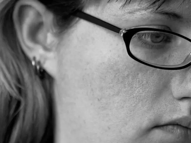 Connections between Macular Edema and Macular Degeneration