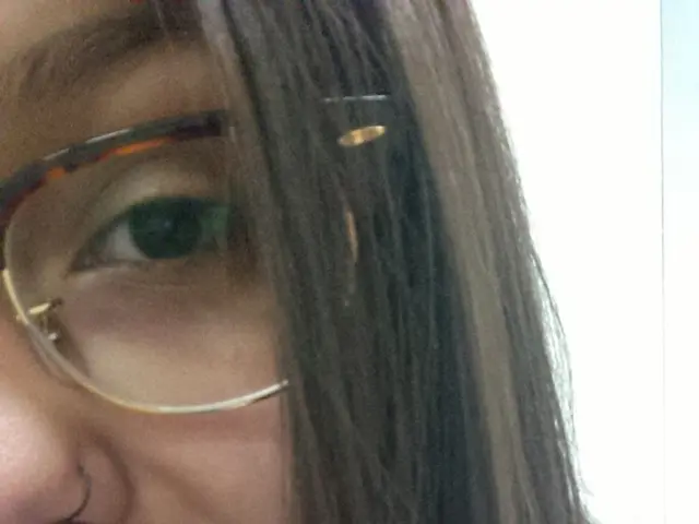 Cataract Surgery Healing Process: Understanding the Aftermath