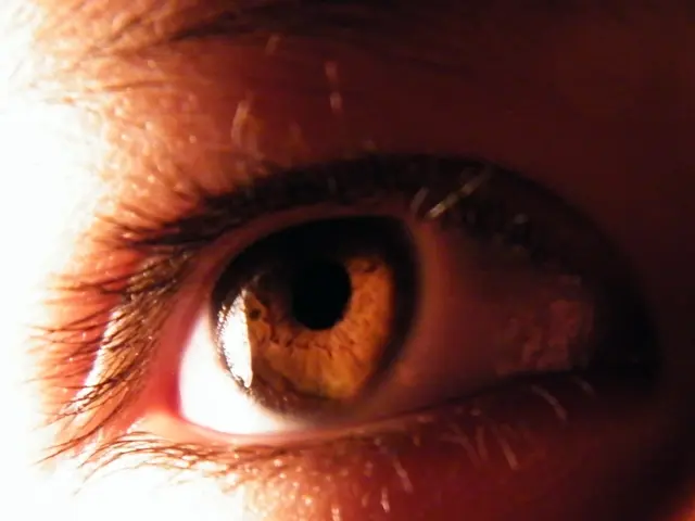 "Proponents for Removing Scaly Eyebrow Flakes Voice Their Approval With a Simple 'Me'"